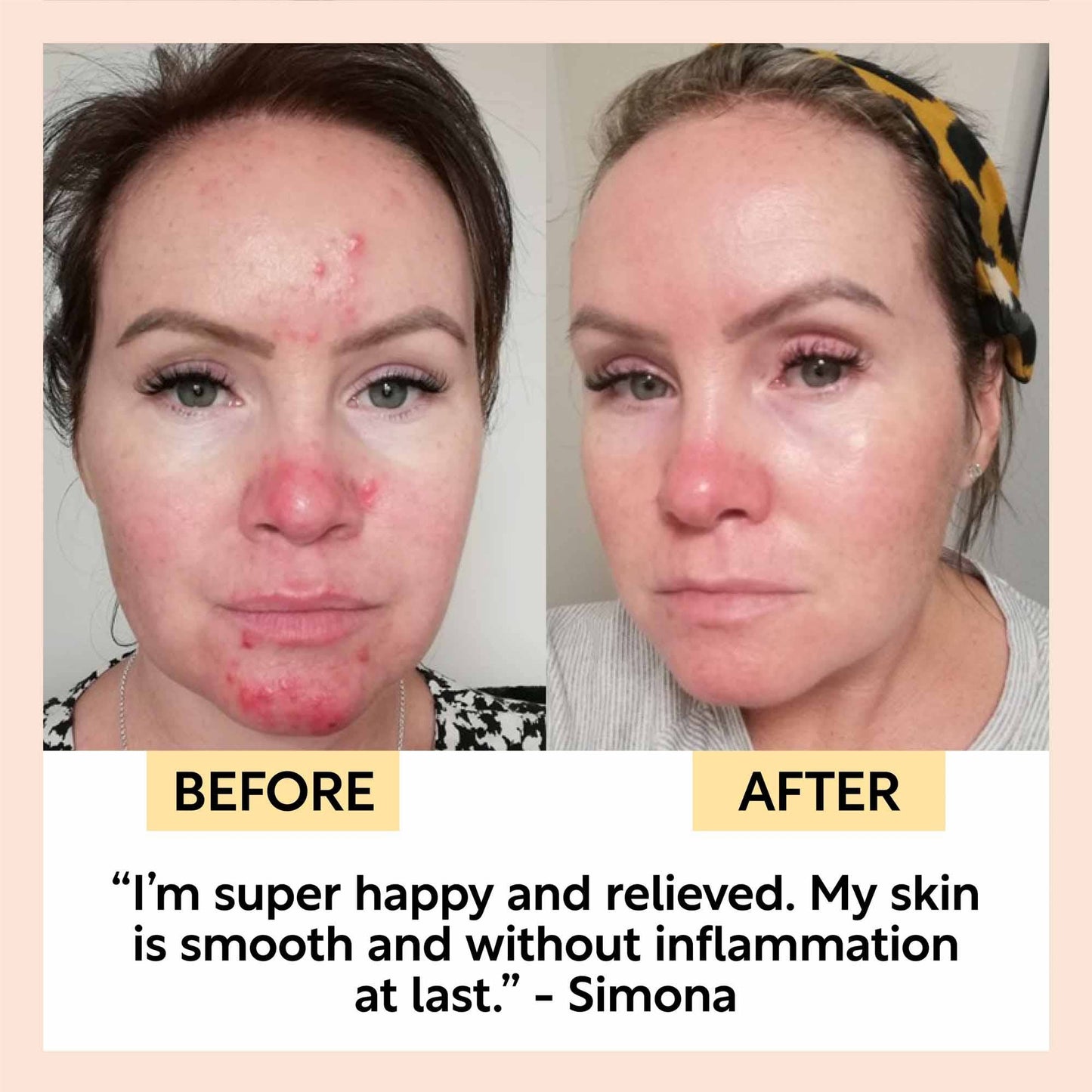 Eco Anti-Aging Spa -yövoide hyaluronihapolla ja niasiiniamidilla, 55ml