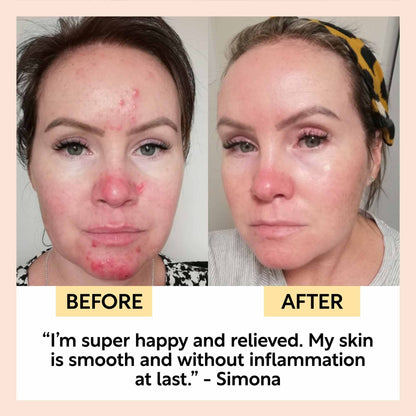 Eco Anti-Aging Spa -yövoide hyaluronihapolla ja niasiiniamidilla, 55ml